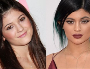 Kylie Jenner Before and After